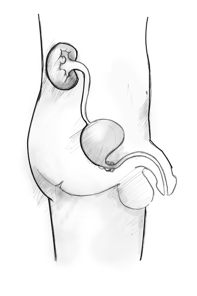 Side view diagram of the male urinary tract. The organs appear within the outline of a young male shown from the abdomen to the thigh.