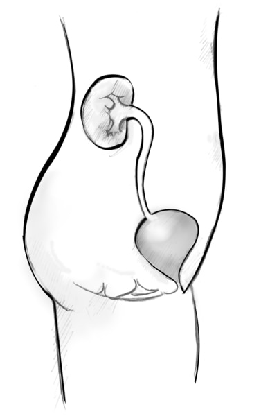 Side view diagram of the female urinary tract. The organs appear within the outline of a young female shown from the abdomen to the thigh.