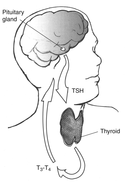 Drawing of the head and neck with the thyroid, pituitary gland, TSH, and T3–T4 labeled. Arrows show the direction of TSH from the pituitary gland to the thyroid gland and of T3–T4 from the thyroid to the pituitary gland.