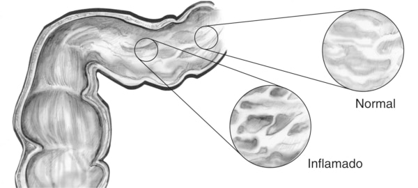 Ilustración del revestimiento del tubo digestivo.
