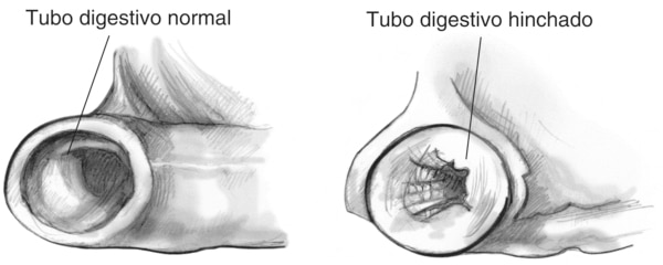 IIlustración de dos cortes transversales del tubo digestivo.