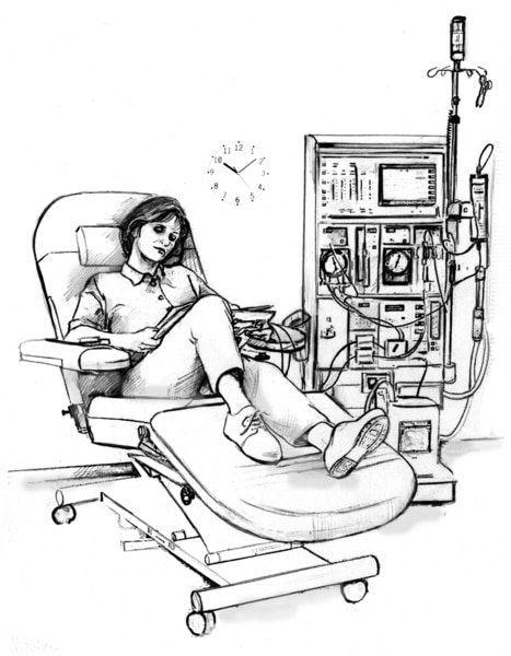 Ilustración de una mujer en diálisis. Ella está sentada en una silla y está conectada a la maquina de diálisis.