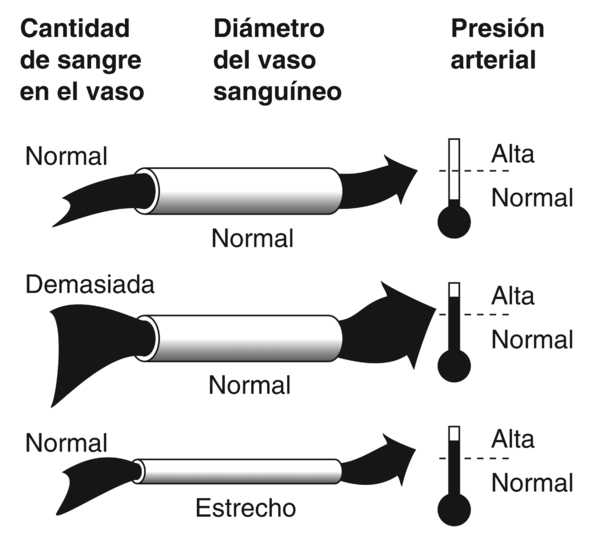 Diagrama de tres vasos sanguíneos. Las etiquetas en la parte superior del diagrama indican “cantidad de sangre en un vaso”, “diámetro del vaso sanguíneo”, y “tensión arterial”. En cada ilustración, la sangre se representa como una flecha que viaja a través de un vaso en forma de tubo. El dibujo superior muestra la cantidad normal de sangre en un vaso de diámetro normal, que da como resultado presión arterial normal. El dibujo del medio muestra demasiada sangre en un vaso sanguíneo de diámetro normal, que da como resultado tensión arterial alta. El dibujo de abajo muestra una cantidad normal de sangre que fluye por un vaso estrecho, que da como resultado tensión arterial alta. A la derecha de cada vaso sanguíneo hay un marcador en forma de termómetro. El marcador a la derecha del dibujo superior está sombreado solamente en la parte inferior, indicando tensión arterial normal. El marcador a la derecha de los dibujos del medio y de abajo están sombreados casi hasta la parte superior, indicando presión arterial alta.