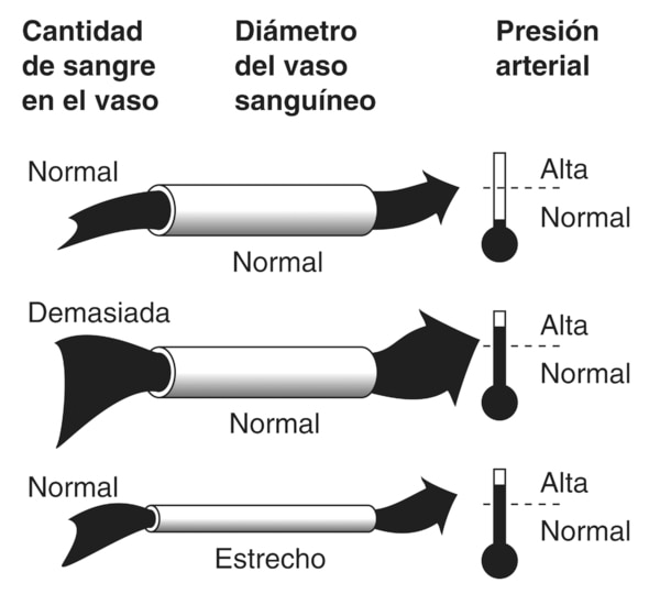 Diagrama de tres vasos sanguíneos. Las etiquetas en la parte superior del diagrama indican “cantidad de sangre en un vaso”, “diámetro del vaso sanguíneo”, y “tensión arterial”. En cada ilustración, la sangre se representa como una flecha que viaja a través de un vaso en forma de tubo. El dibujo superior muestra la cantidad normal de sangre en un vaso de diámetro normal, que da como resultado presión arterial normal. El dibujo del medio muestra demasiada sangre en un vaso sanguíneo de diámetro normal, que da como resultado tensión arterial alta. El dibujo de abajo muestra una cantidad normal de sangre que fluye por un vaso estrecho, que da como resultado tensión arterial alta. A la derecha de cada vaso sanguíneo hay un marcador en forma de termómetro. El marcador a la derecha del dibujo superior está sombreado solamente en la parte inferior, indicando tensión arterial normal. El marcador a la derecha de los dibujos del medio y de abajo están sombreados casi hasta la parte superior, indicando presión arterial alta.