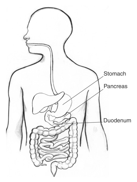 Drawing of the digestive tract with the stomach, pancreas, and duodenum labeled.