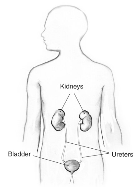 Drawing of the urinary tract in a male figure with labels for the kidneys, bladder, and ureters.