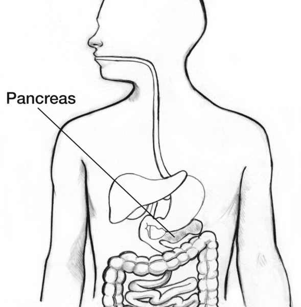 Drawing of a body torso showing the pancreas and part of the digestive system, with the pancreas labeled.