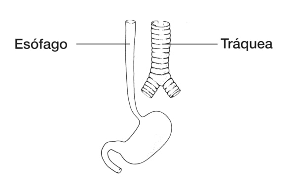 Dibujo de un esófago de desarrollo normal, se señalan el esófago y la tráquea.
