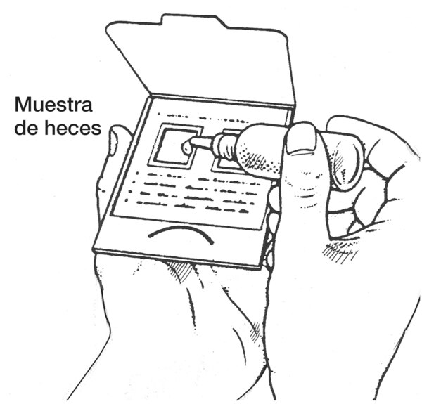 Dibujo de manos sosteniendo una tarjeta que contiene una muestra de heces, se etiqueta “Muestra de heces”.