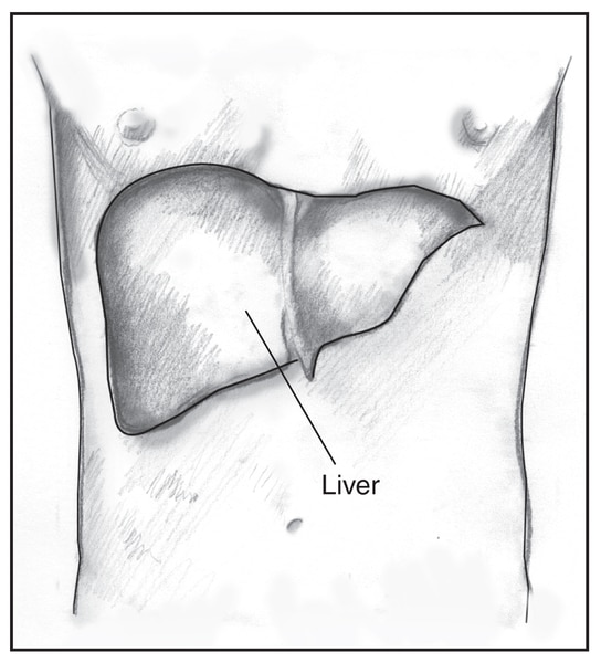 Drawing of a male torso with the liver highlighted and labeled.