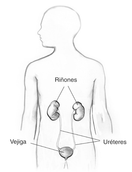 Ilustración de las vías urinarias en una figura masculina. Se señalan los riñones, la vejiga y los uréteres.