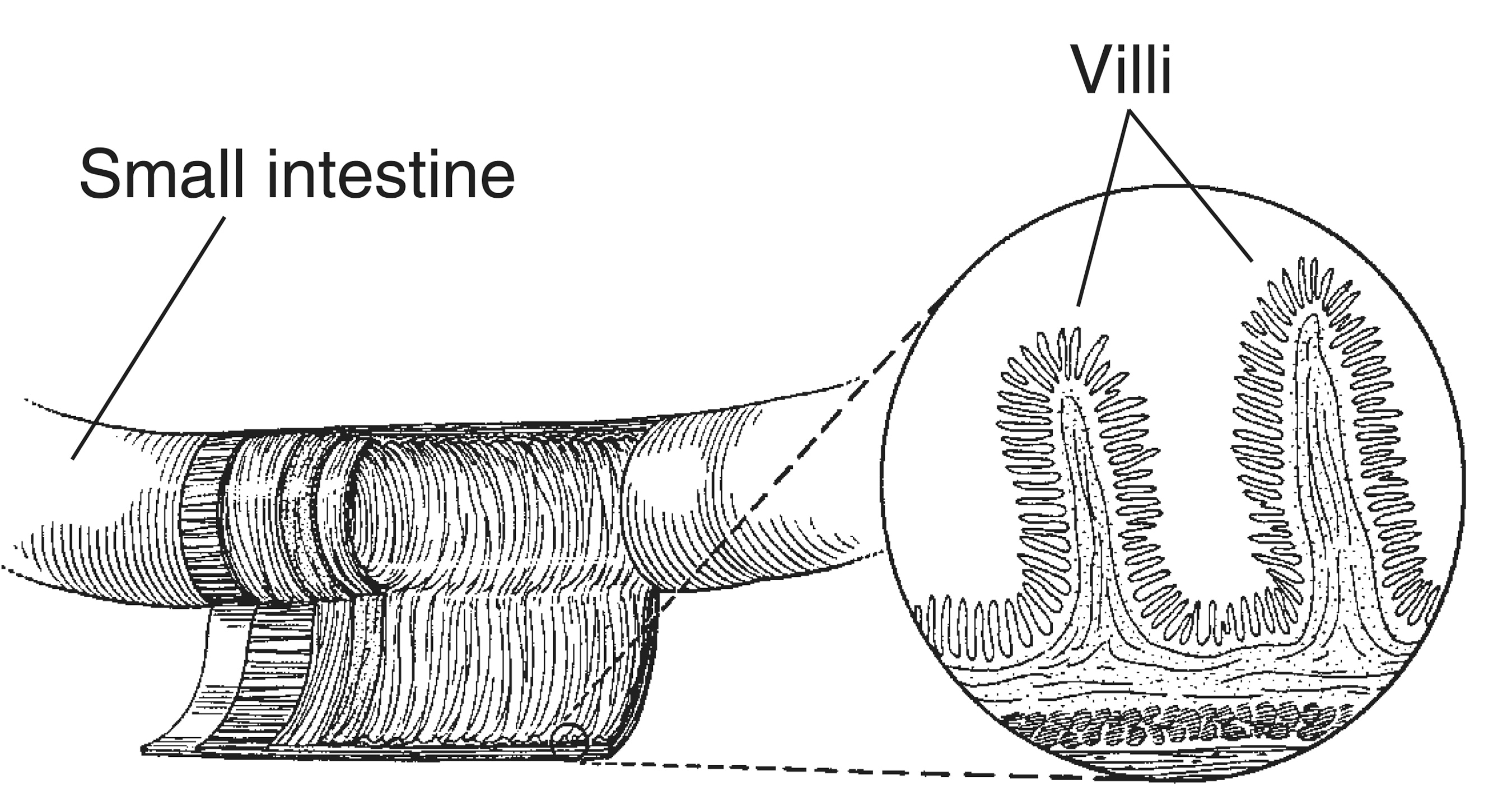 Villi gаstricae. Dense перевод