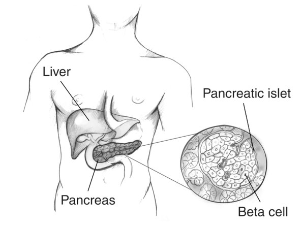 Drawing of a male torso showing the location of the liver and the pancreas with an enlargement of a pancreatic islet containing beta cells.