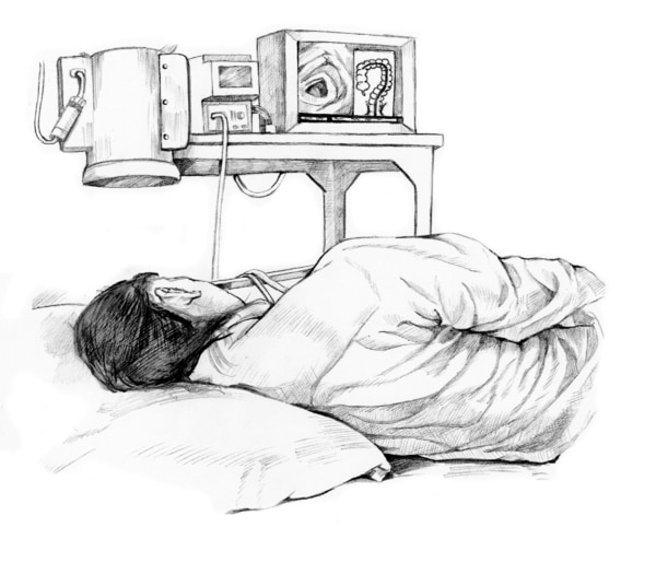 Dibujo de una paciente de colonoscopia, recostada sobre su lado izquierdo en una camilla.