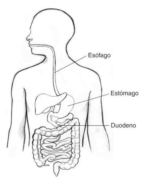 Dibujo del tracto digestivo en el que se señala el esófago, estómago y duodeno.