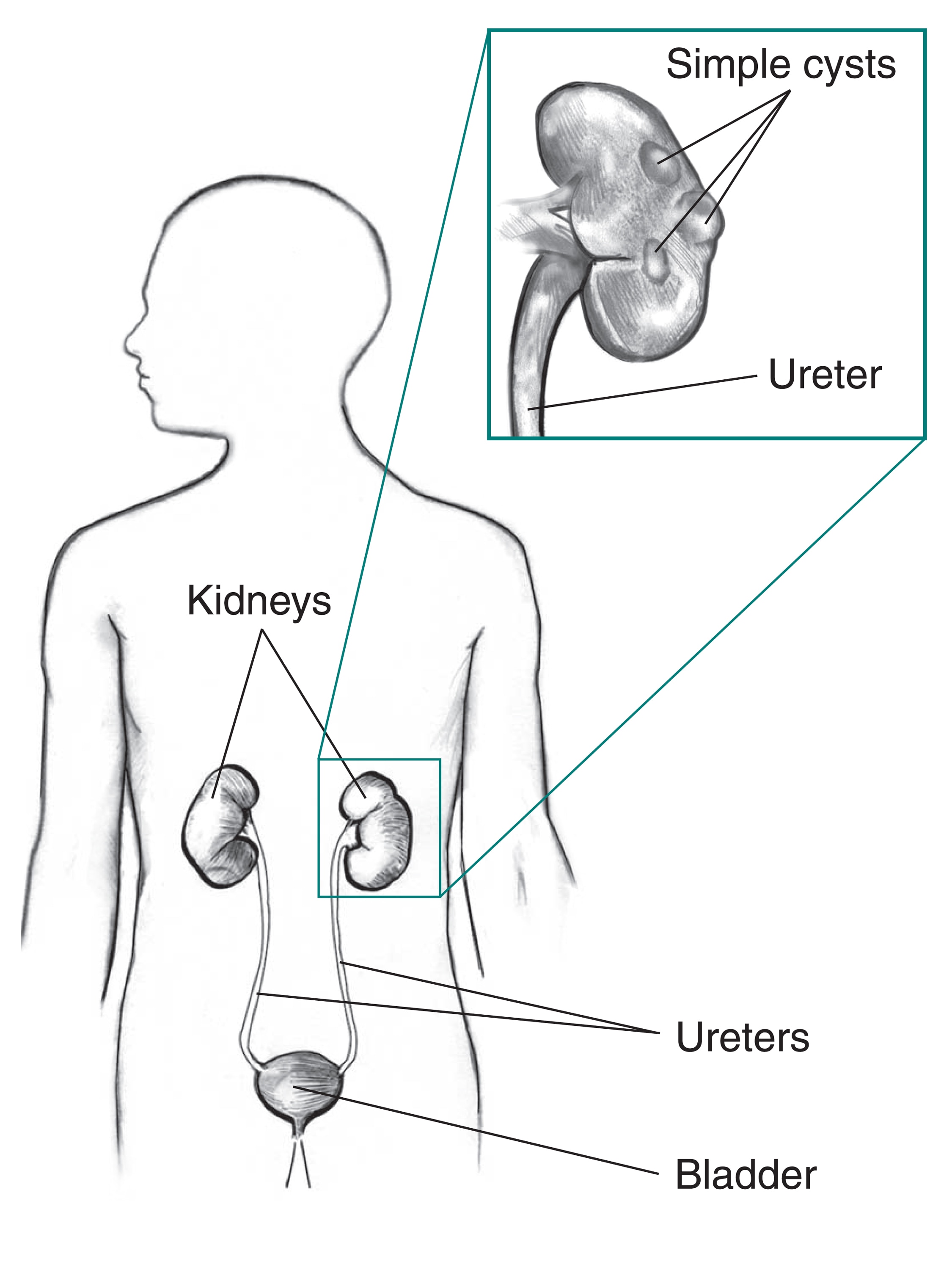 Draw a diagram of the human excretory system and label the various parts. -  Brainly.in