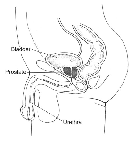 Drawing of the side view of the male urinary tract, with the bladder, prostate, and urethra labeled.