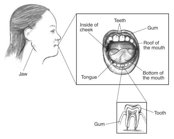 Drawing of the profile of a woman’s face with the jaw labeled. Inset of the mouth with the teeth, gum, roof of the mouth, bottom of the mouth, tongue, and inside of cheek labeled. A second inset of a tooth with the tooth and gum labeled.