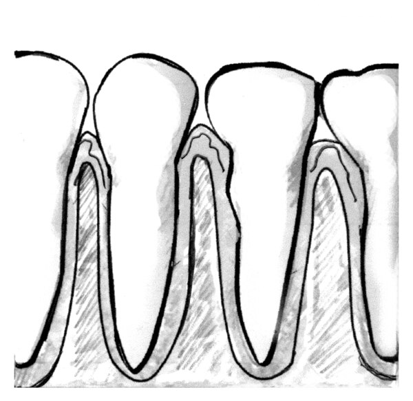 Drawing of a close-up view of teeth and healthy gums.