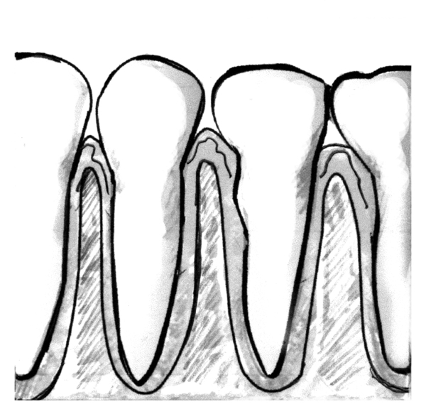 Drawing of a close-up view of teeth and healthy gums.