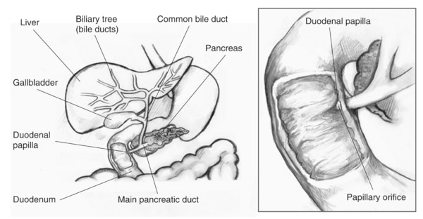 Drawing of the biliary system with the liver, biliary tree (bile ducts), common bile duct, gallbladder, pancreas, duodenal papilla, main pancreatic duct, and duodenum labeled. Inset of an enlarged biliary system with the duodenal papilla and papillary ori