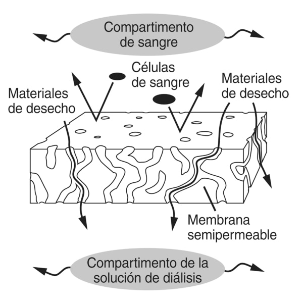 Ilustración de una sección de una membrana semipermeable que se puede utilizar en un dializador. La sección se asemeja a una esponja. El área encima de la membrana se identifica “Compartimento de sangre”. El área debajo de la membrana se identifica “Compa