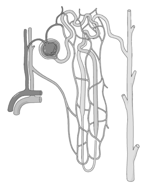 Ilustración de una nefrona, una estructura microscópica que contiene vasos sanguíneos diminutos entrelazados con un túbulo.