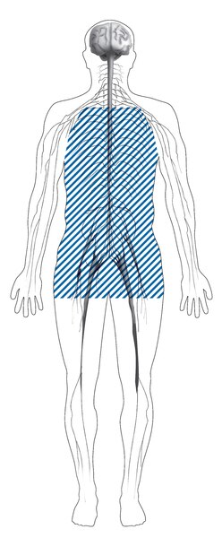 Ilustración de la silueta de un cuerpo con líneas sombreadas que muestra la ubicación de los nervios afectados por la neuropatía autónoma.