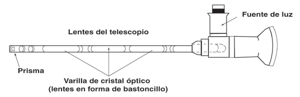 Imagen de un citoscopio con sus partes descritas.