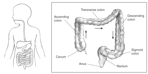 Drawing of the lower gastrointestinal tract inside the outline of a man’s torso with an inset that includes labels for cecum, ascending colon, transverse colon, descending colon, sigmoid colon, rectum, and anus