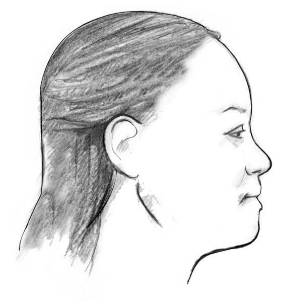 Dibujo del perfil de la cara de una mujer con la mandíbula.