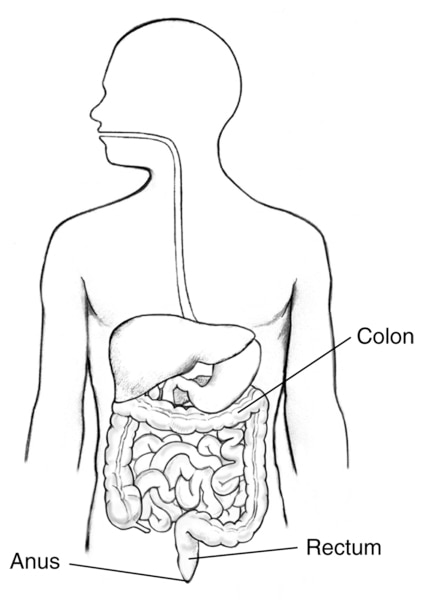 Illustration of the digestive tract within an outline of the top half of a human body. The colon, rectum, and anus are labeled.