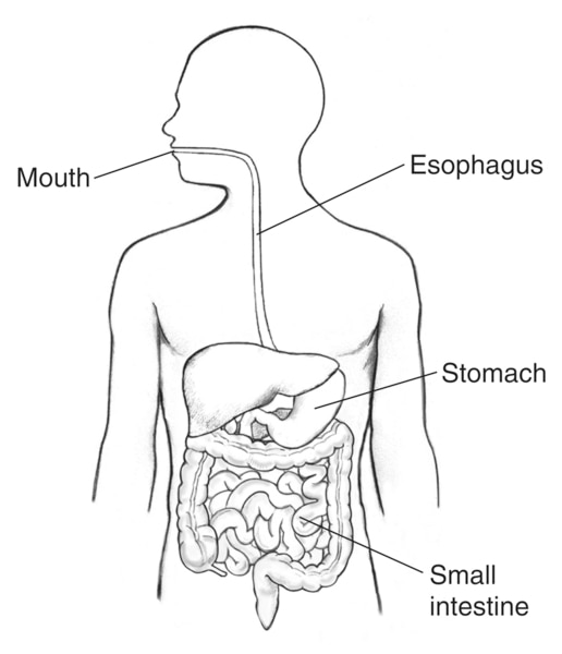 Illustration of the digestive tract within an outline of the top half of a human body. The mouth, esophagus, stomach, and small intestine are labeled.