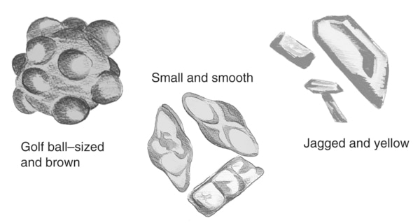 Drawing of three kidney stones of various shapes. The stones are labeled golf ball–sized and brown, small and smooth, and jagged and yellow.