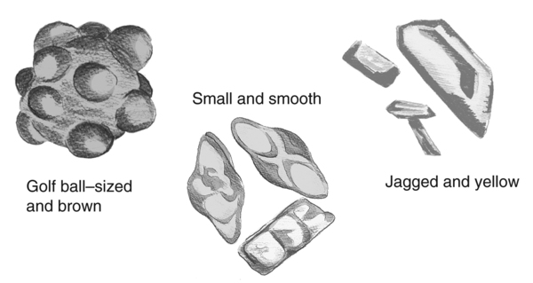 Drawing of three kidney stones of various shapes. The stones are labeled golf ball–sized and brown, small and smooth, and jagged and yellow.