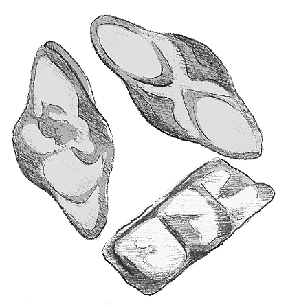 Drawing of a small and smooth kidney stone.