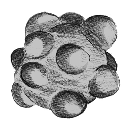 Drawing of golf-ball sized and brown kidney stone.