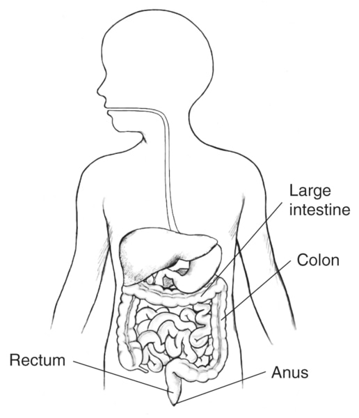 Drawing of the digestive tract within an outline of the top half of a child’s body. The large intestine, colon, rectum, and anus are labeled.
