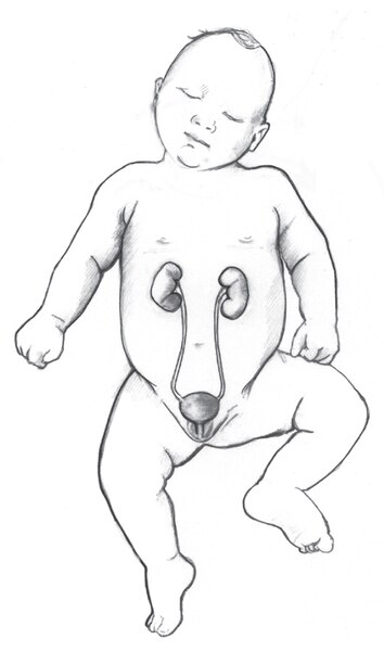 Front-view drawing of a normal urinary tract in an infant.