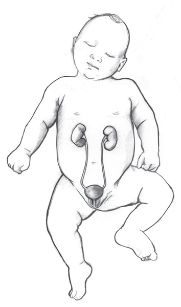 Front-view drawing of a normal urinary tract in an infant.