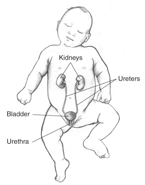 Front-view drawing of a normal urinary tract in an infant. The kidneys, ureters, bladder, and urethra are labeled.