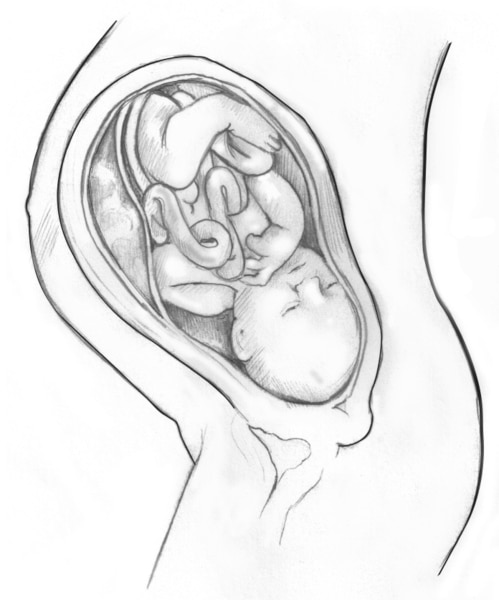 Side-view drawing of a developing baby in the womb in the outline of the mother.