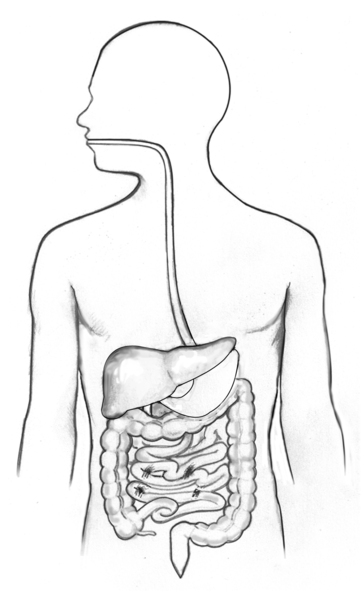 Drawing of the gastrointestinal tract showing the esophagus, stomach, and large intestine.