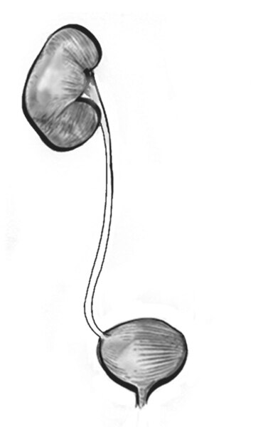 Drawing of one kidney and the bladder.