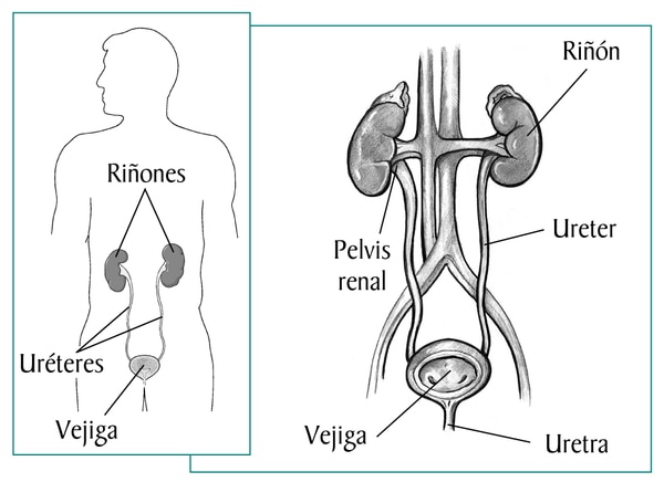 Diagrama de vías urinarias normales con un recuadro que tiene una imagen masculine.