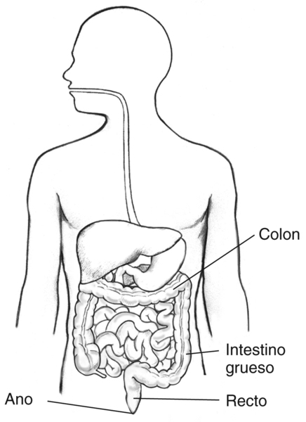 Imagen del tubo digestivo con un contorno de la parte superior del cuerpo humano. El colon, el recto y el ano están etiquetados.