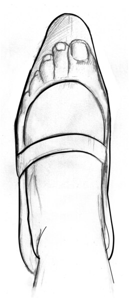 Drawing of a poorly fitted shoe.