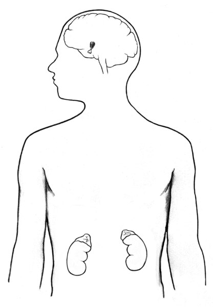 Drawing of human body outlining brain and kidneys.