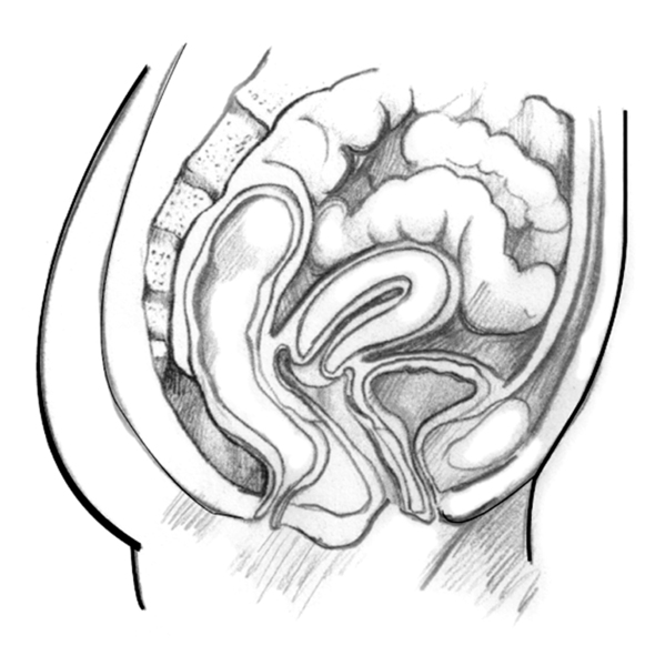 Drawing of a woman’s pelvic area with the cervix, vagina, urethra, bladder, small intestine, and uterus.