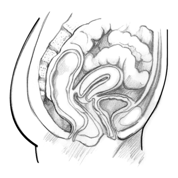 Drawing of a woman’s pelvic area with the cervix, vagina, urethra, bladder, small intestine, and uterus.